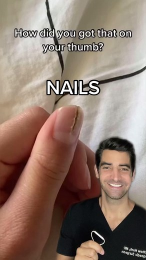 Understanding Nail Dystrophy of Heller