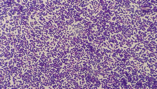 The Longest-Running Evolution Experiment Has Been Going For 80,000 Generations