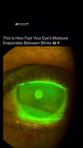 Scigeniushub | Follow (us) @scigeniushub to know how things work. #viral #explore #howeverythingworks #reels #physics | Instagram