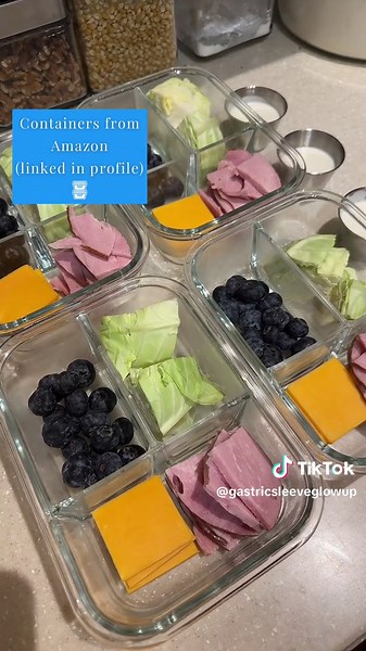 Shaina, Gastric Sleeve Glow Up on TikTok