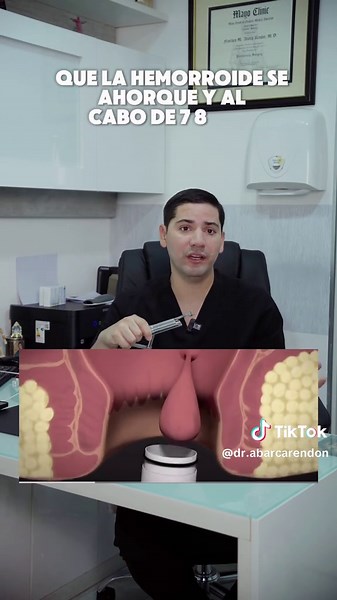 Hemorroides: Todo sobre la ligadura hemorroidal