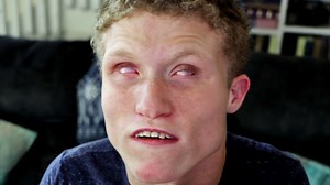 446K views · 7.7K reactions | Jonathan lives with a mysterious illness that is believed to be caused by environmental factors. Professionals say his syndromes may be caused by the fact that he was born in a part of the world that is heavily polluted. Jonathan and his family want others to know that they are doing their best and they hope that you extend them grace. | Special Books by Special Kids | Facebook