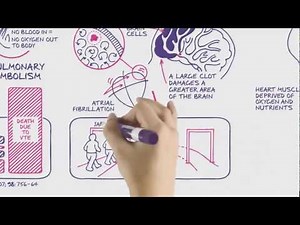 Why A Blood Clot Is Serious