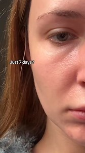 762K views · 3.9K reactions | The KSECRET Seoul 1988 Serum: Retinal...