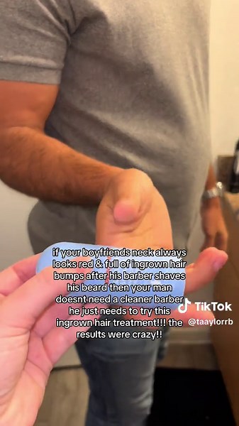 Effective Ingrown Hair Treatment for Smooth Skin