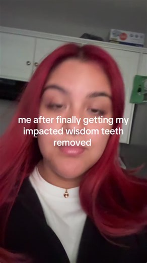 My Experience After Wisdom Teeth Removal