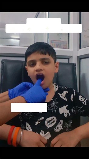 Target Sound "ड" (da) Tongue Placement:- Curl your tongue tip slightly backward so it touches the hard palate (just behind the alveolar ridge). Don’t make it too far back — you should feel the tongue against the roof of the mouth. 🤷‍♀️💬👍 🗣 #speechtherapy #speech #adhd #kidsactivities #autismawareness | Shining Stars