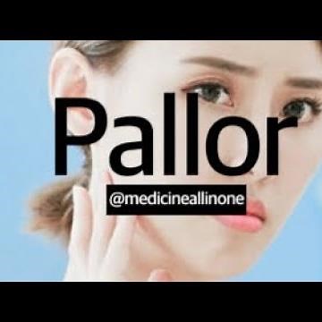 Pallor- General Examination / causes / diagnosis/ treatment- paleness of skin