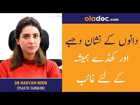 How To Get Rid Of Acne Scars Urdu Hindi - Danon Ke Nishan Khatam Karne Ki Tips - Remove Pimple Marks