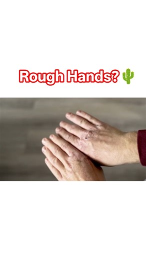 SOFT Hands in 1 Min! ✨🧤 #shorts #dryhands