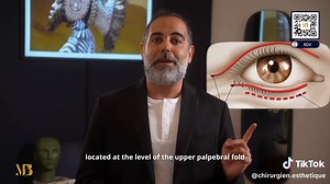 Souffrez-vous de paupières tombantes ou d'un regard fatigué ? Découvrez la blépharoplastie supérieure, une solution efficace pour rajeunir votre regard et retrouver une apparence reposée. Dans cette vidéo, je vous explique tout ce qu'il faut savoir sur : ✅ Les causes de l'excès de peau des paupières (vieillissement, génétique). ✅ Le déroulement de la première consultation avec votre chirurgien. ✅ Les options chirurgicales adaptées : paupières supérieures, inférieures ou les deux. ✅ Les précautio