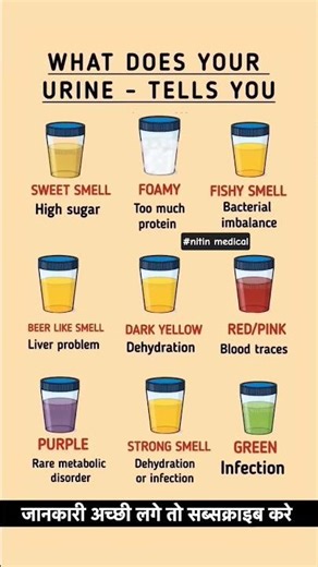 What Your Urine Color and Smell Say About Your Health | Early Sign You Shouldn't Ignore #healthylife