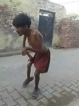 Funny dance disabled man