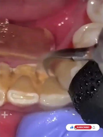 #viral #dentist #video