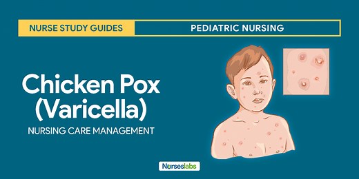 Chicken Pox (Varicella)
