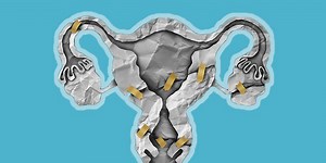 'I Had Vaginal Reconstruction Surgery And It Transformed My Sex Life'