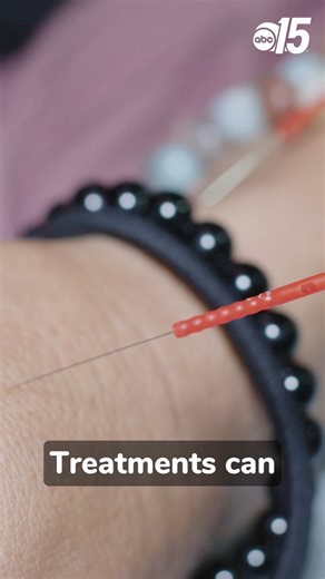 3.2K views | Acupuncture is a traditional Chinese medical technique that involves inserting thin needles into specific points along meridians in the body.律‍♀️ "Acupuncture works in so many different things, and it's such a great way to heal and reduce pain," said Laura Ellis, acupuncturist. ️Amanda Kinseth Giorgio Citarella https://bit.ly/45Ru6g7 | WPDE ABC15 | Facebook