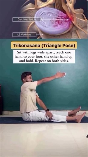 Don't Stretch Your Piriformis If You Have Right-Side Sciatica #spinehealth #slipdiscsurgery #deepyog