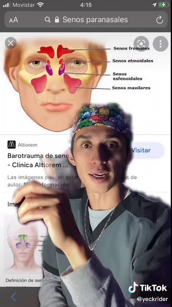 Uso del expander Hyrax en ortodoncia