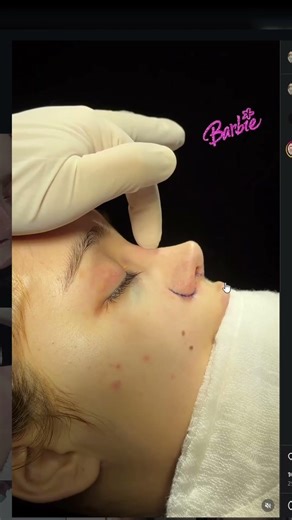 İşte Bu Doktor İşini Biliyor! #facialcode #yüzanalizi #shorst