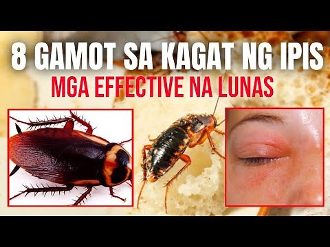 Mga Effective na lunas sa kagat ng ipis | first aid for cockroach bite.