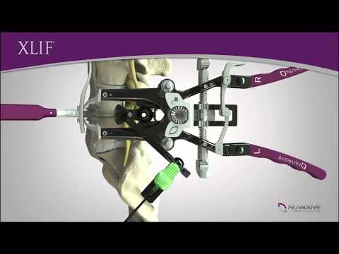 XLIF procedure animation