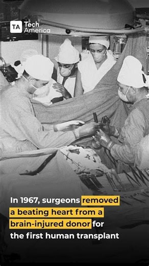 The First Human Heart Transplant in 1967