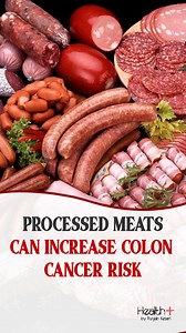 Processed Meats Can Increase Colon Cancer Risk #cancer #coloncancer #processedmeat | Health
