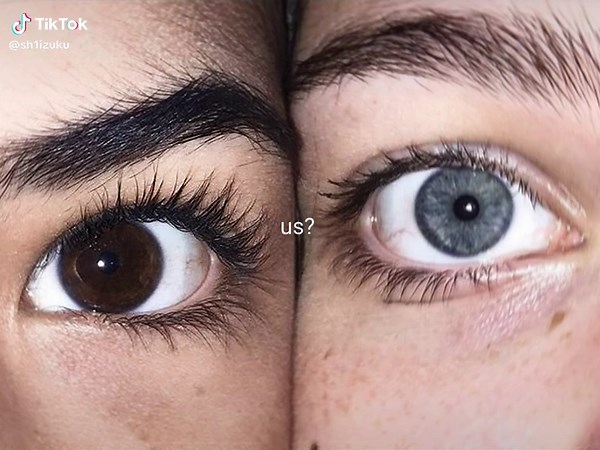 Understanding Eye Color: Blue vs. Brown Eyes