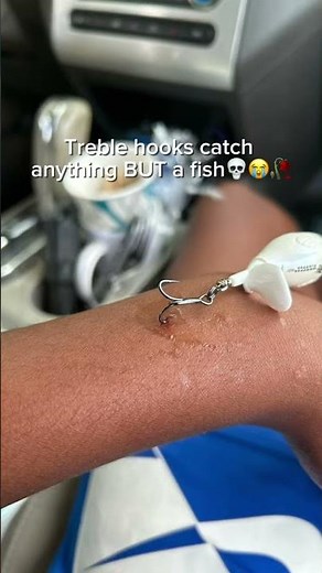 The whopper plopper is gone 😭