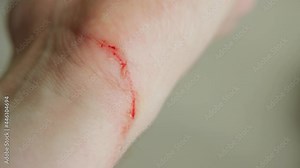 Wound cut on a man's hand, close-up. Blood on the wrist, skin