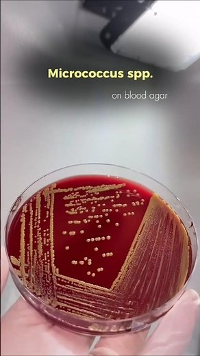 Micrococcus spp. Colonies on Blood Agar