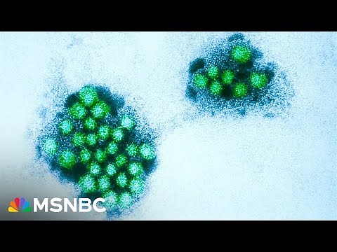 What to know about the highly-contagious norovirus surge