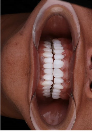 Transform Your Smile with Expert Care in Colombia