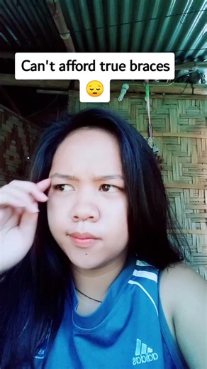 DIY BRACES❤️♥️ #foryoupage #foryou #instantbraces #whodoyoulove #lovemyfans