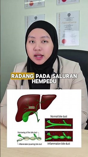 4 PUNCA YANG BOLEH MENINGKATKAN RISIKO SAKIT PERUT DI SEBELAH KANAN(Read Description Below)