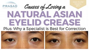 Causes of Losing a Double Eyelid Crease — The Doctor Explains