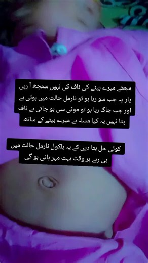 Understanding Baby's Belly Button Changes