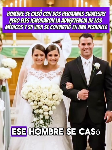 The Fascinating Story of Siamese Twins in the News