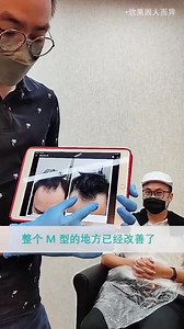 1.6K views · 12 reactions | 当DHT雄性激素累积越多的时候，毛囊就会萎缩和变得更薄弱，进而导致严重脱发问题。 Hair Doc Folli-Lite 生发头帽采用650纳米wave length 可加强头皮血液循环、让头皮注满营养、瞬间刺激头发生长，同时长出茁壮头发。 100%安全无副作用 在此观看Hair Doc协助顾客解决头皮问题的真实案例 立即PM我们 | Hair Doc | Facebook