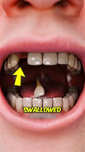 If You Ever Swallow a Tooth, This Is What Happens 😳
