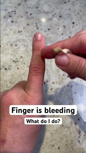 Finger bleeding? Try this… (then remove rubber band after 15min)