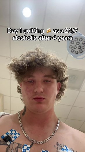Journey of Overcoming Alcohol Dependency: Day by Day