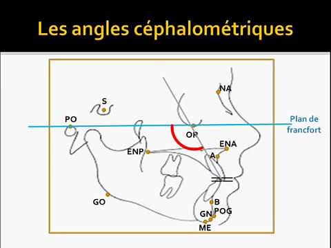 Cephalometry part 2: angles and interpretations