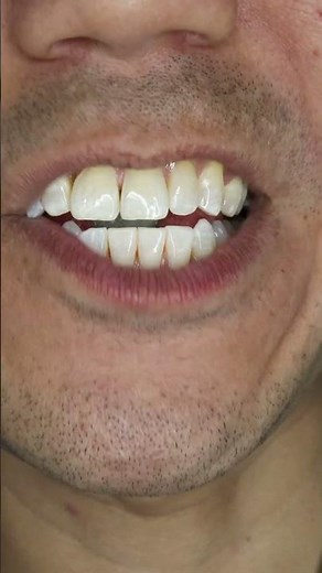 “Super Sour” Nobel Super Soda Candy ASMR #shorts #asmr