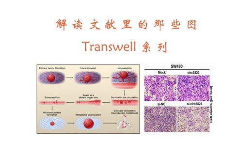 解读文献里的那些图：Transwell系列