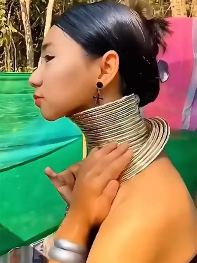 La dolorosa verdad detrás de los anillos para el cuello