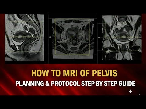 How to Perform MRI of Pelvis | Positioning & Sequences Explained