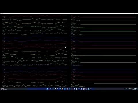 Real Time EEG Plotting using PyQtgraph