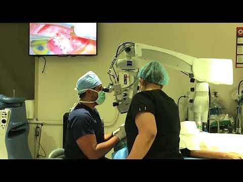 Scissorless Pterygium Surgery With Glue